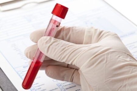 Guía para comprender los valores de referencia en pruebas de laboratorio
